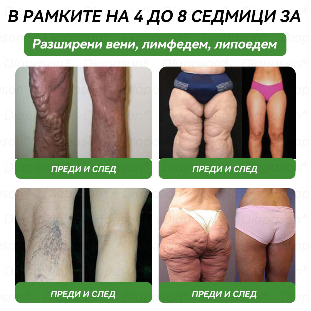 𝐃𝒊𝓪𝐩𝓪𝙨𝐨𝒏®𝐺𝐿𝑃-1 Седем в едно здраве решение перорален течност💞Само веднъж на ден, видими промени след 7 дни) При затлъстяване, сърдечно-съдови заболявания, диабет, сънна апнея, чревно здраве, проблеми със ставите и други⏰