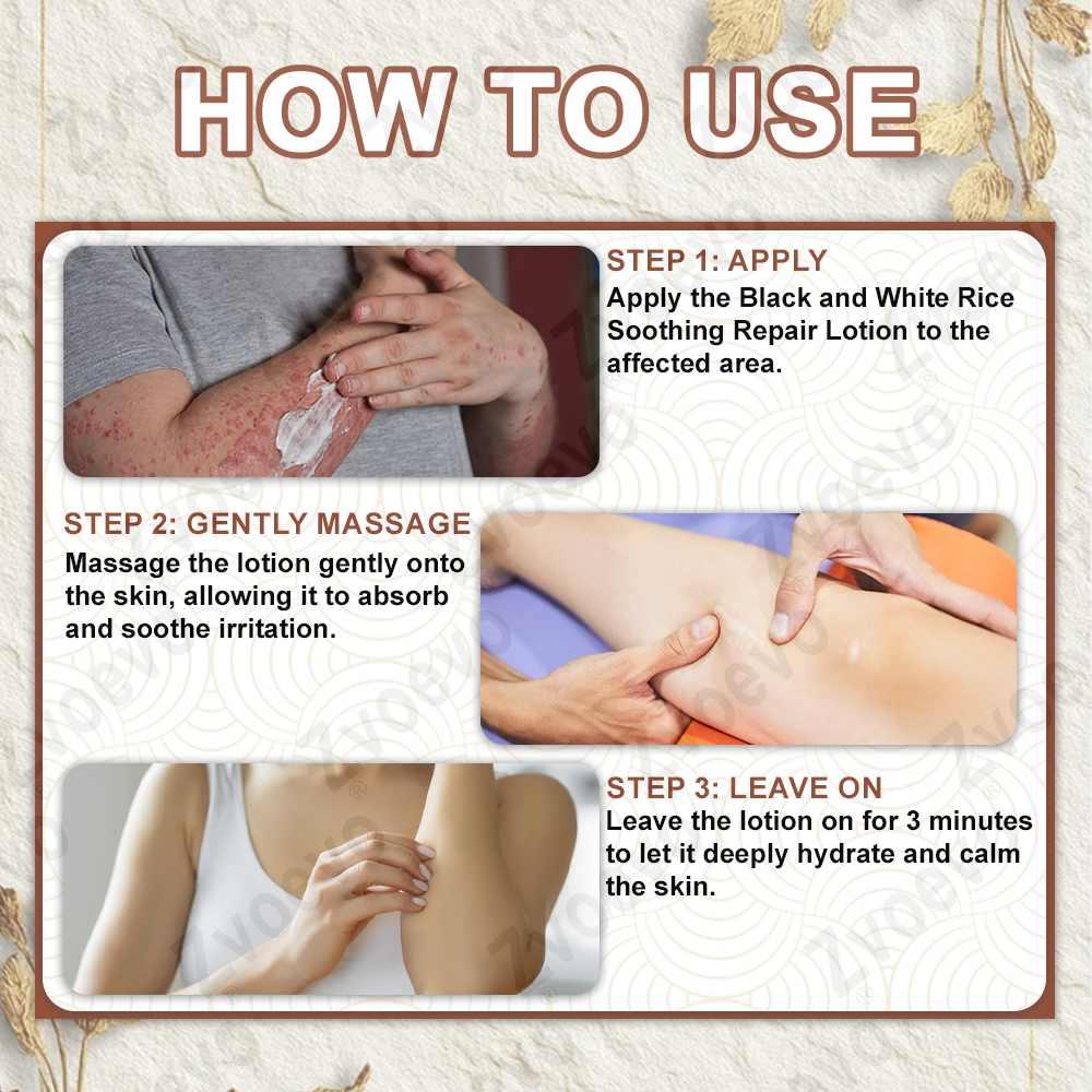 Zvoevo® Black Rice Skin Repair Essence Cream 👩🏻⚕️ Сертифициран от MHRA (Премахва брадавици и кожни образувания, подобрява натрупването на кератин и себорейния дерматит, фоликуларна кератоза, рак на кожата и старчески петна) ⏰