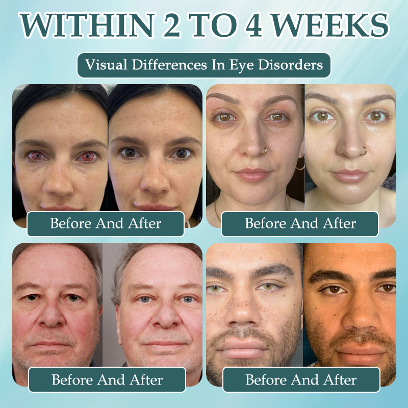 Spzv® OptiFusion Nano очен серум 👩⚕️ Нанотехнология за възстановяване на ясно зрение, без очила, без операция ⏰