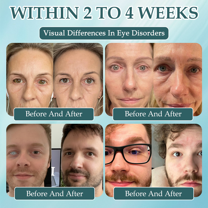 Spzv® OptiFusion Nano очен серум 👩⚕️ Нанотехнология за възстановяване на ясно зрение, без очила, без операция ⏰