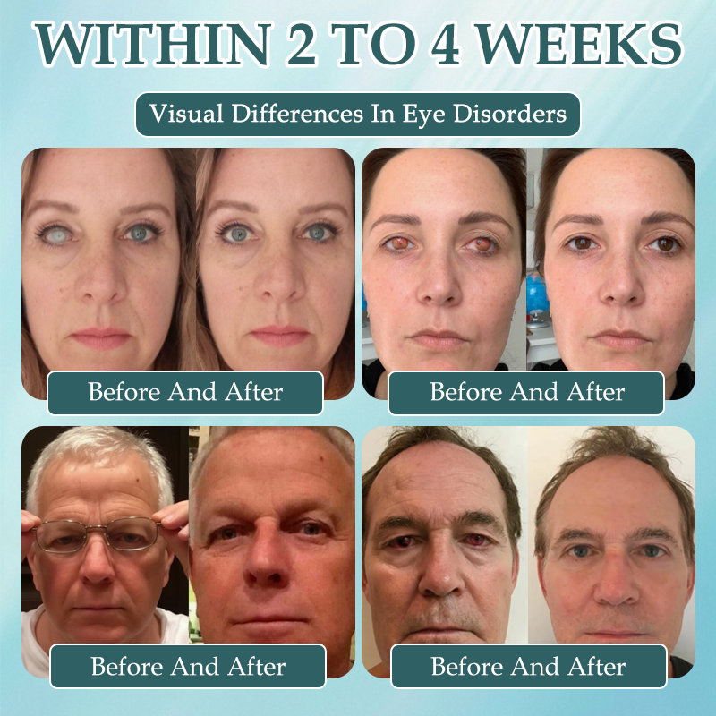 Spzv® OptiFusion Nano очен серум 👩‍⚕️ Нанотехнология за възстановяване на ясно зрение, без очила, без операция ⏰