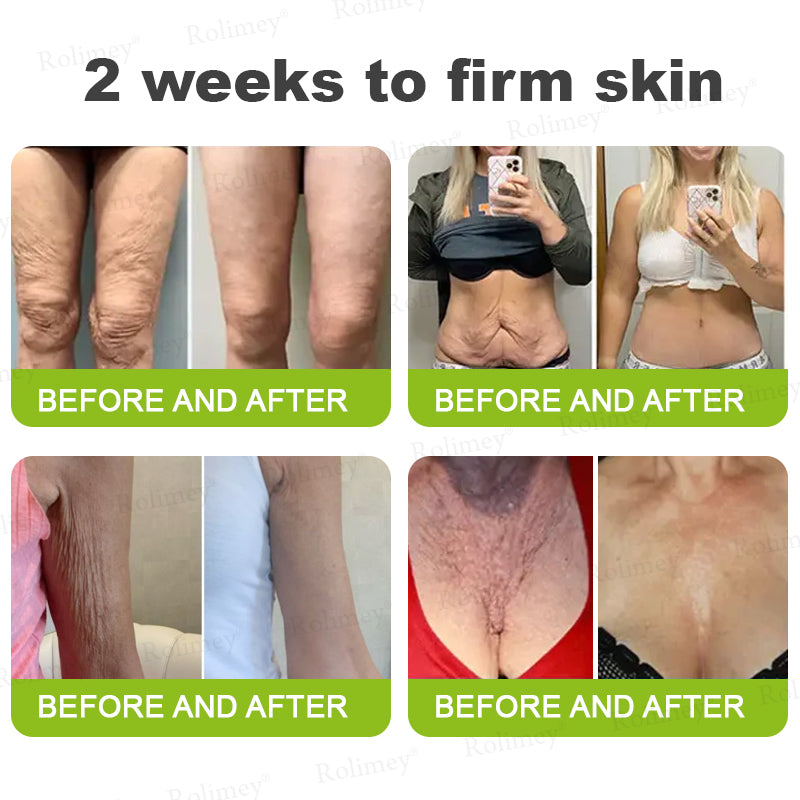 Произведено и изпратено от САЩ ✅ Rolimey® Botox & Vita-A Retinol Shot Крем против бръчки и за стягане на кожата – Последен ден на промоцията: 70% ОТСТЪПКА!