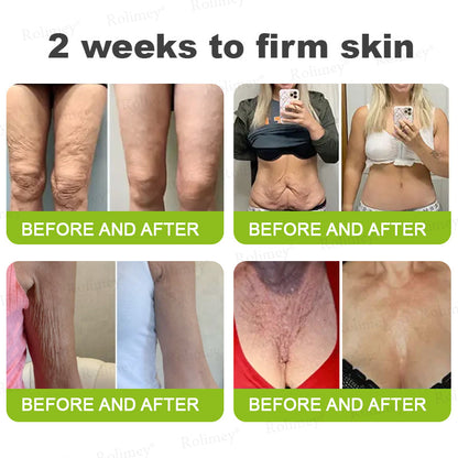 Произведено и изпратено от САЩ ✅ Rolimey® Botox & Vita-A Retinol Shot Крем против бръчки и за стягане на кожата – Последен ден на промоцията: 70% ОТСТЪПКА!