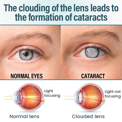 Spzv® OptiFusion Nano очен серум 👩‍⚕️ Нанотехнология за възстановяване на ясно зрение, без очила, без операция ⏰