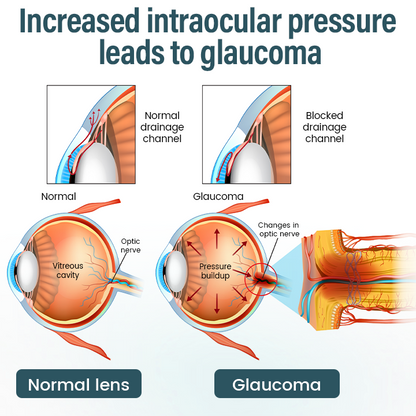Spzv® OptiFusion Nano очен серум 👩‍⚕️ Нанотехнология за възстановяване на ясно зрение, без очила, без операция ⏰