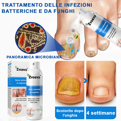 Официален магазин: Zvoevo® Спрей с магнезий и натурални билки за псориазис ☘️(Облекчава псориазис и екзема, подобрява бактериални инфекции в гениталната зона, третира акне и брадавици, облекчава ставни и невропатични болки)⏰
