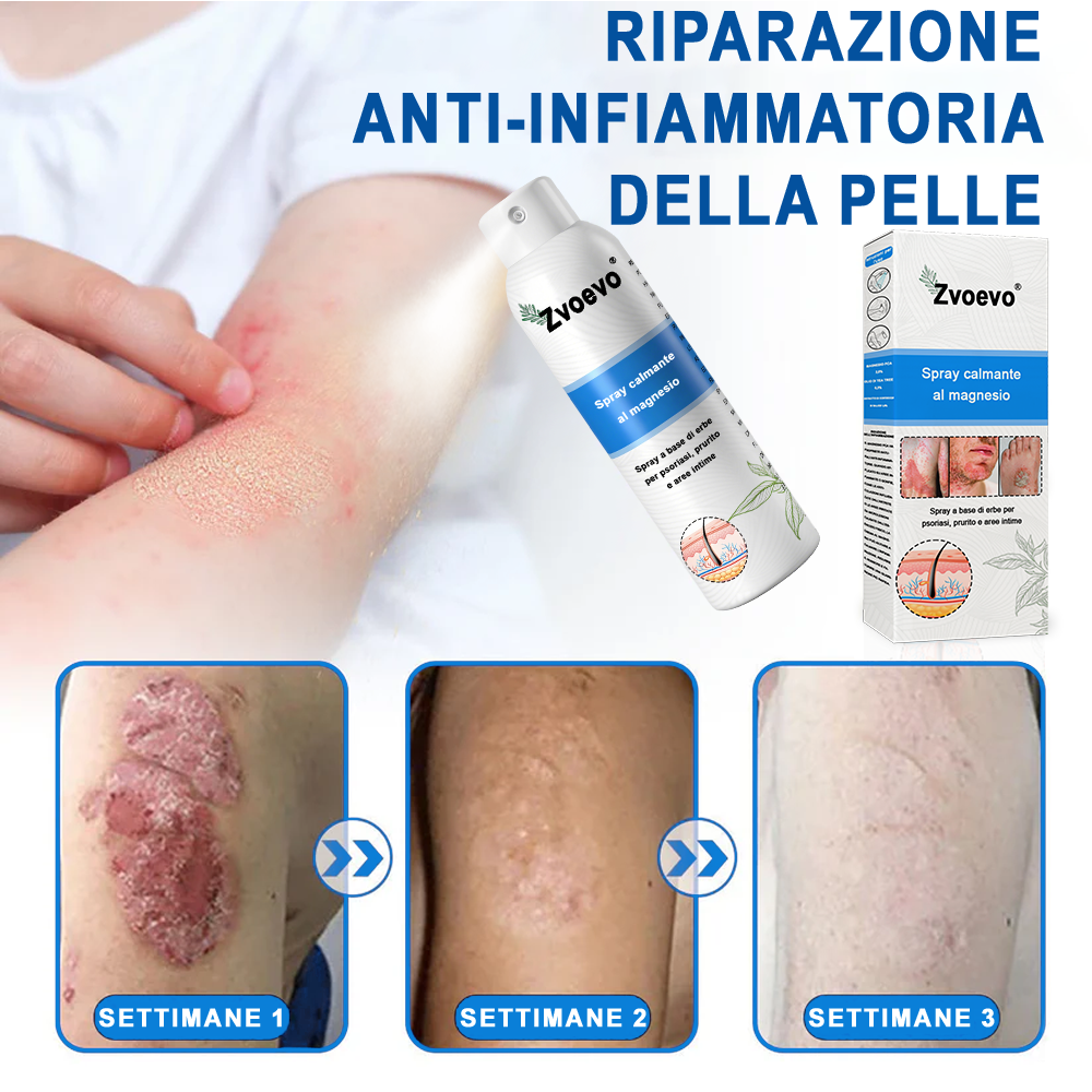 Официален магазин: Zvoevo® Спрей с магнезий и натурални билки за псориазис ☘️(Облекчава псориазис и екзема, подобрява бактериални инфекции в гениталната зона, третира акне и брадавици, облекчава ставни и невропатични болки)⏰
