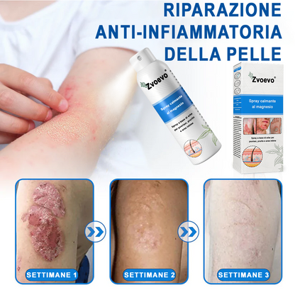 Официален магазин: Zvoevo® Спрей с магнезий и натурални билки за псориазис ☘️(Облекчава псориазис и екзема, подобрява бактериални инфекции в гениталната зона, третира акне и брадавици, облекчава ставни и невропатични болки)⏰