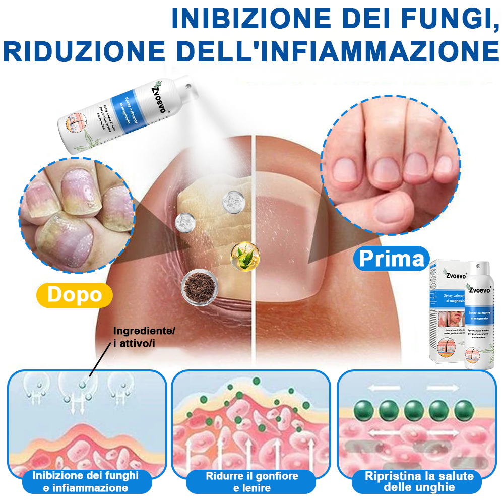 Официален магазин: Zvoevo® Спрей с магнезий и натурални билки за псориазис ☘️(Облекчава псориазис и екзема, подобрява бактериални инфекции в гениталната зона, третира акне и брадавици, облекчава ставни и невропатични болки)⏰